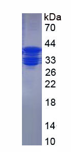 Recombinant Hepcidin (Hepc)