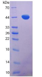 Recombinant Tau Protein (MAPT)