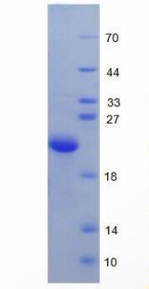 Recombinant Hemojuvelin (HJV)