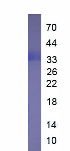 Recombinant Apolipoprotein A5 (APOA5)