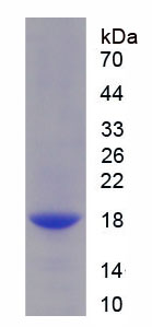 Recombinant Complement Factor B (CFB)