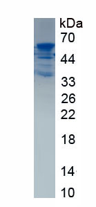 RPC011Hu04.jpg