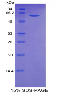 Recombinant Complement Factor B (CFB)