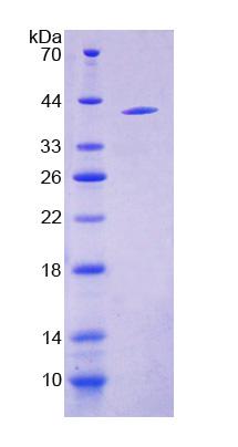 Recombinant Cytochrome P450 17A1 (CYP17A1)