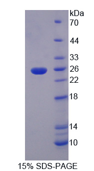 Recombinant Transferrin (TF)