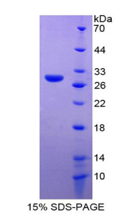 Recombinant Matrix Metalloproteinase 14 (MMP14)