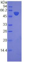 Recombinant Laminin Beta 3 (LAMb3)