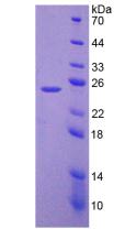 Recombinant Laminin Beta 3 (LAMb3)