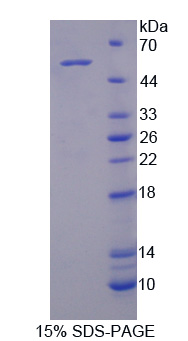 Recombinant Activin A Receptor Type I C (ACVR1C)