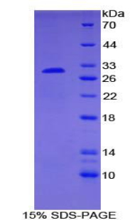 Recombinant SMAD family member 6 (SMAD6)