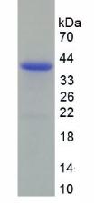 Recombinant Decorin (DCN)