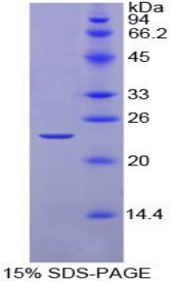 Recombinant Noggin (NOG)