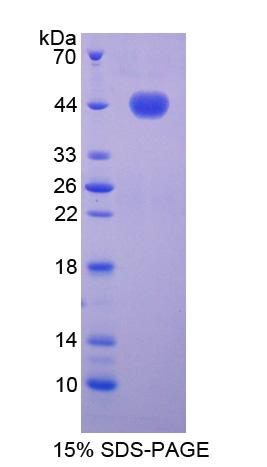 Recombinant Noggin (NOG)