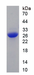 Recombinant Noggin (NOG)