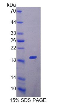 RPC150Hu01.jpg