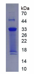 RPC156Hu01.jpg