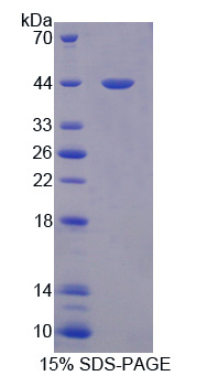 RPC170Hu01.jpg