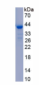 RPC176Hu01.jpg