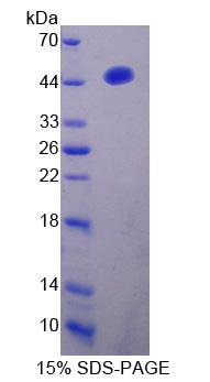 RPC180Hu01.jpg