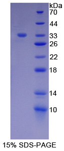 RPC187Hu01.jpg