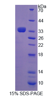 RPC190Hu01.jpg