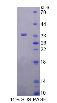 RPC193Hu01.jpg