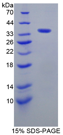 RPC197Hu01.jpg