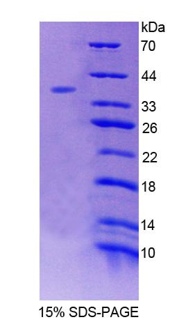 RPC212Hu01.jpg