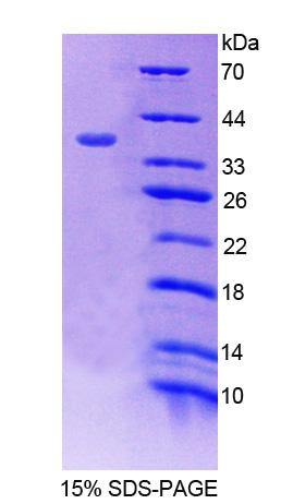 RPC225Hu01.jpg