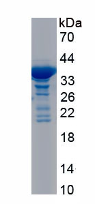 Recombinant Telomerase Reverse Transcriptase (TERT)