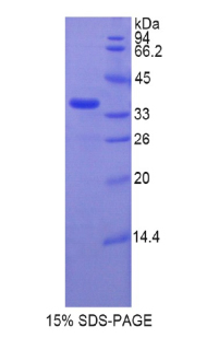 Recombinant Telomerase Reverse Transcriptase (TERT)