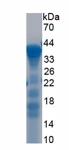 Recombinant Topoisomerase I (TOP1)