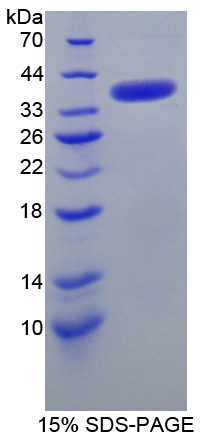 RPC256Hu01.jpg