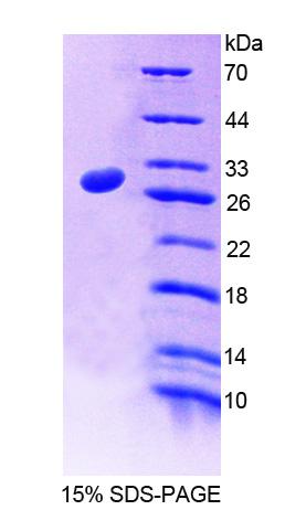 Recombinant Centromere Protein J (CENPJ)