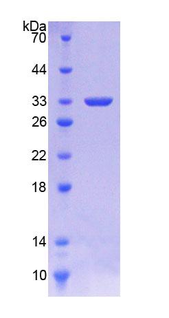 Recombinant Antithrombin (AT)