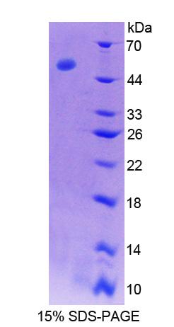 Recombinant Antithrombin (AT)