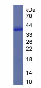 Recombinant Corticotropin Releasing Hormone Binding Protein (CRHBP)