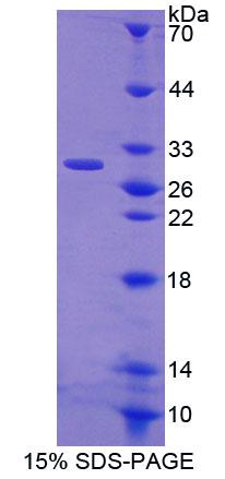 Recombinant Cysteine Rich Secretory Protein 1 (CRISP1)