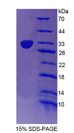 RPC412Hu01.jpg