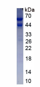 Recombinant Catalase (CAT)