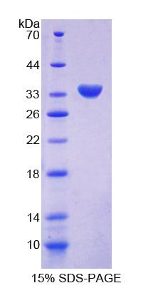 RPC420Hu01.jpg