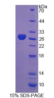 Recombinant Dystrobrevin Binding Protein 1 (DTNBP1)