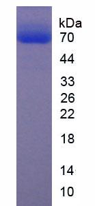 Recombinant Extracellular Matrix Protein 1 (ECM1)