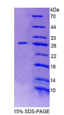 Recombinant Cytosolic Ovarian Carcinoma Antigen 1 (COVA1)