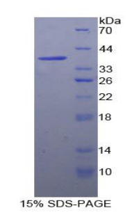 RPC470Hu01.jpg