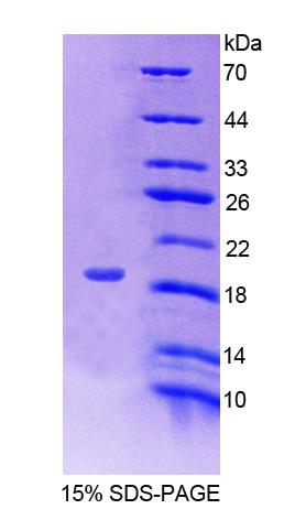 RPC479Hu01.jpg