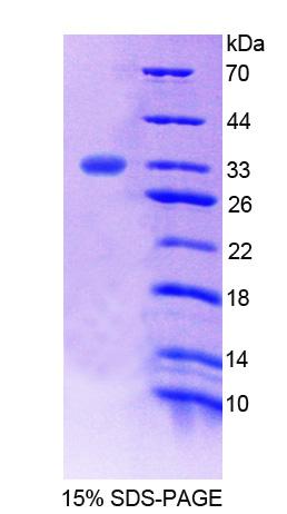 RPC482Hu01.jpg