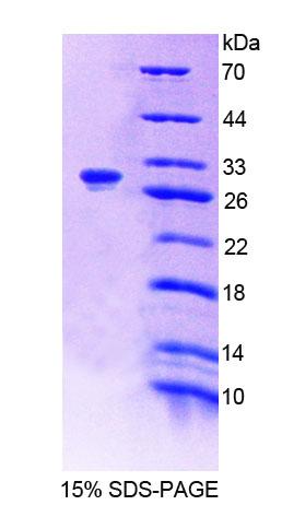 Recombinant G-Elongation Factor, Mitochondrial 1 (GFM1)