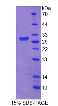 RPC521Hu01.jpg