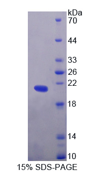 RPC529Hu01.jpg